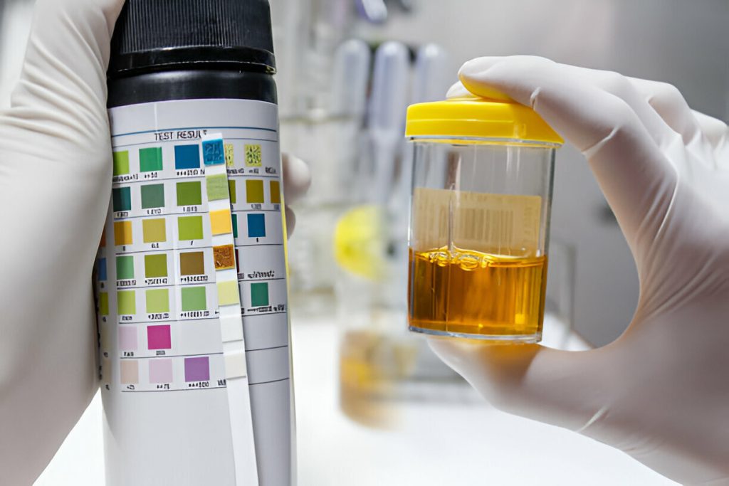 doctors order urine drug screens