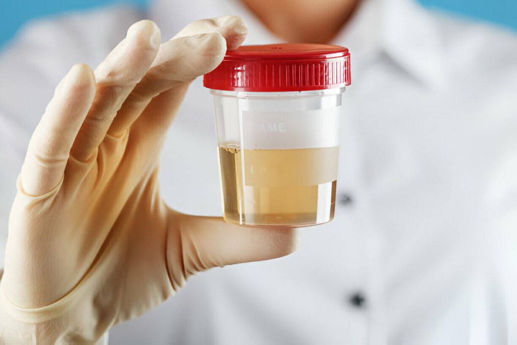 Urine Be Stored Before Testing for Drugs