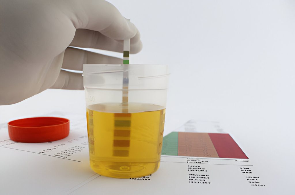 How Far Back Does a Urine Drug Screen Test?