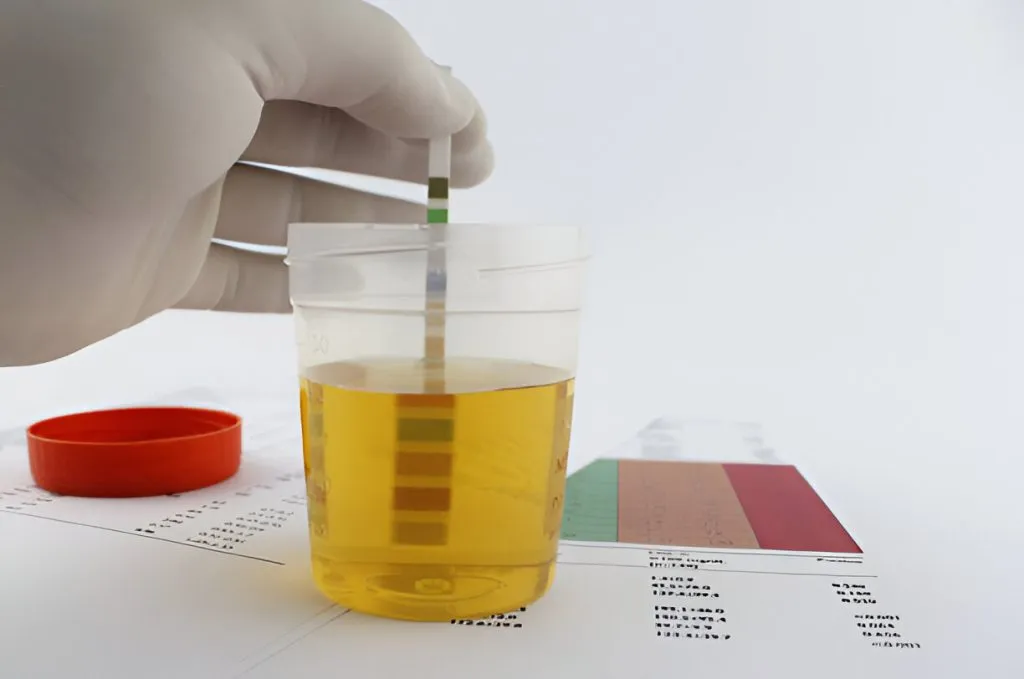 How Far Back Does a Urine Drug Screen Test?