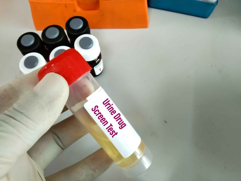 Negative Drug Test Result