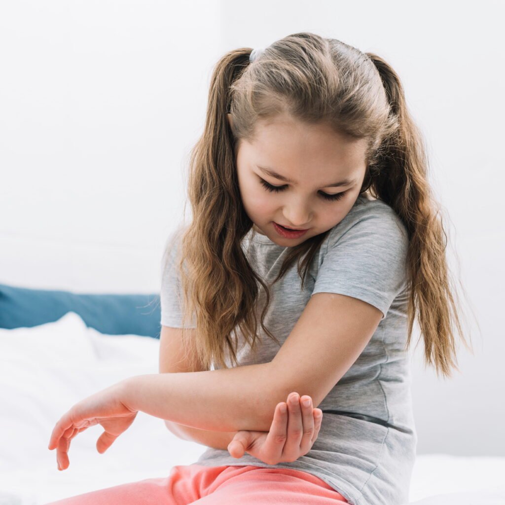 pediatric-eczema-treatment