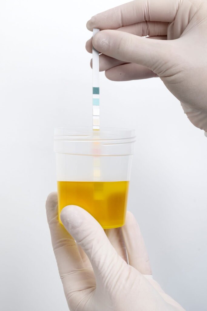 how-long-can-you-keep-pee-for-a-urine-test