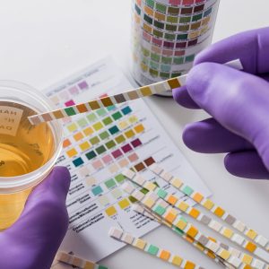 Urine Drug Screening