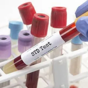 std-testing-laboratory-service