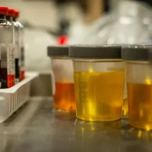 urinalysis-&-culture​