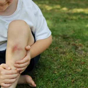 Cuts & Bruises